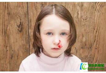 孩子容易流鼻血是因为空气干燥吗