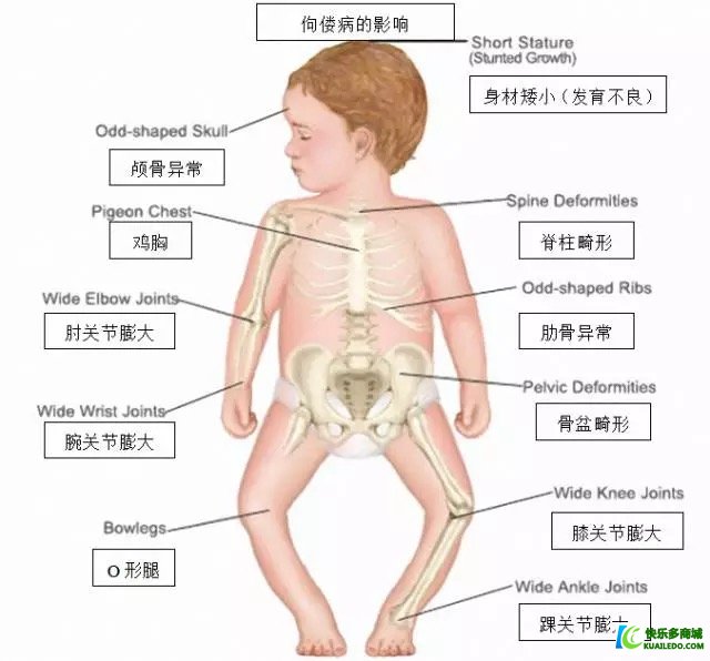 为啥孩子需要晒太阳?