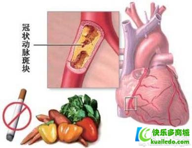 疗养冠心病的最佳方案是什么?