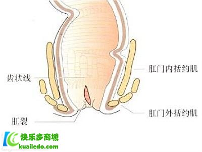 疗养肛裂最好办法有哪些 三分钟快速把握疗养肛裂的方案