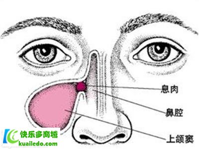 额窦炎吃什么药效果好 盘点疗养额窦炎有奇效的4种药品