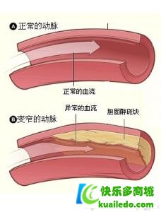 第1步