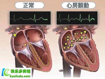 [揭密]阿司匹林适合什么人吃 推举五类人群快速防护心血管病患