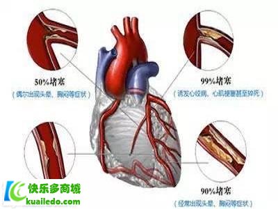 [揭密]阿司匹林适合什么人吃 推举五类人群快速防护心血管病患