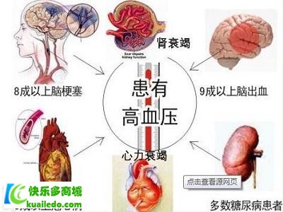 [揭密]高血压遗传吗 分析高血压的因素及操纵方案